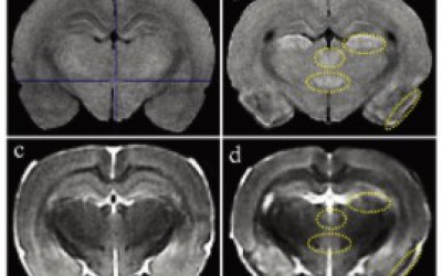小动物磁共振成像系统在大鼠脑损伤评估中的应用